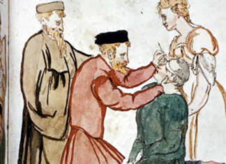 representacio moderna d una intervencio de cataractes al segle xv font galeria de metges catalans 1 630x630